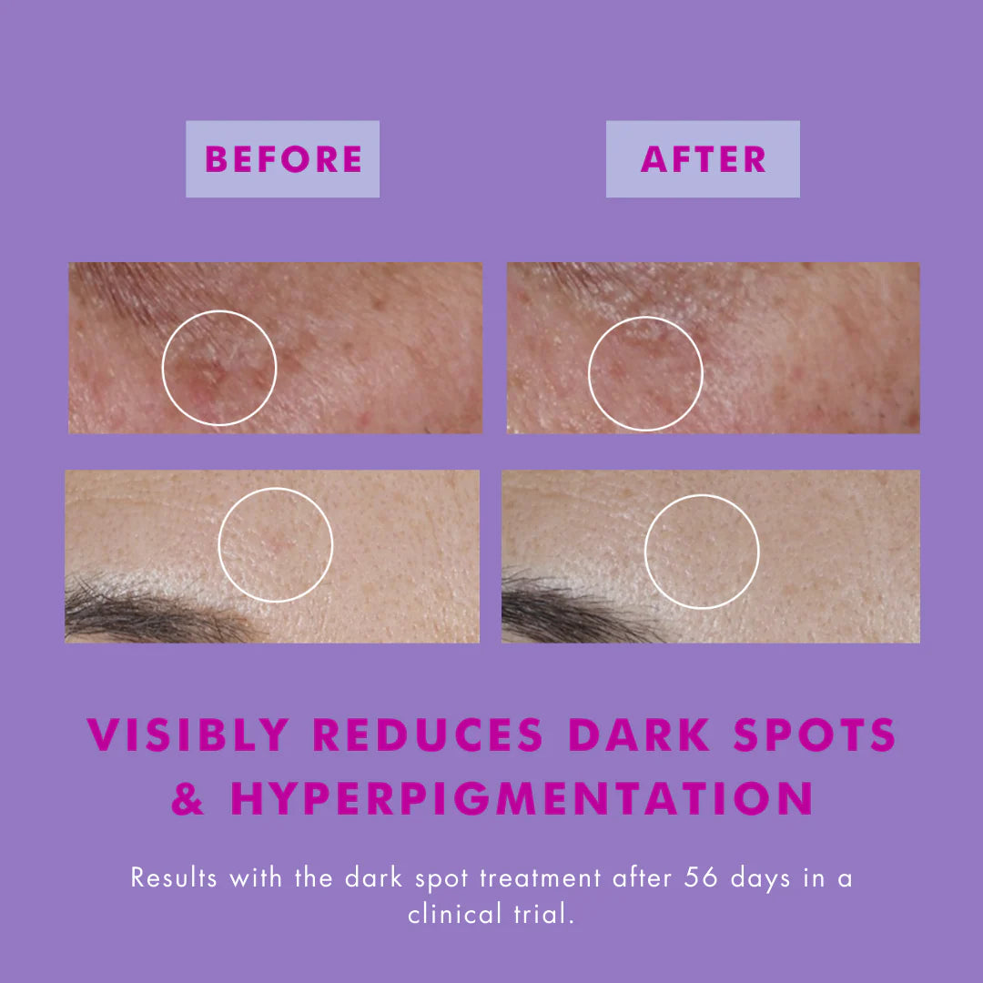 The One That Makes You Glow SPF40 Dark Spot Treatment with Hexylresorcinol