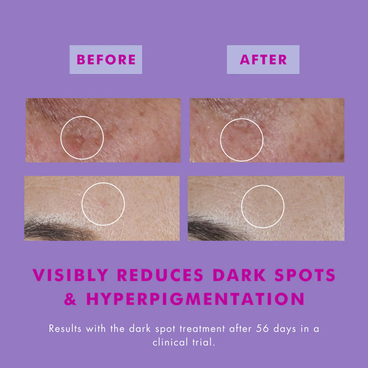 The One That Makes You Glow SPF40 Dark Spot Treatment with Hexylresorcinol
